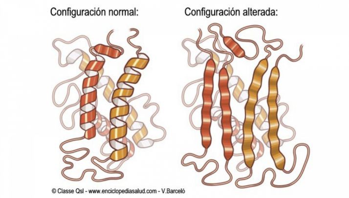 El Campus investiga el impacto social de un tipo de enfermedades raras, las priónicas