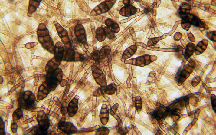 Esporas de Alternaria alternata/Ninjatacoshell