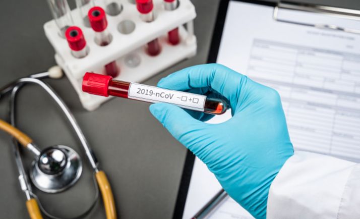 El Laboratorio Regional de Sanidad Animal puede realizar análisis de PCR para detectar el Covid-19