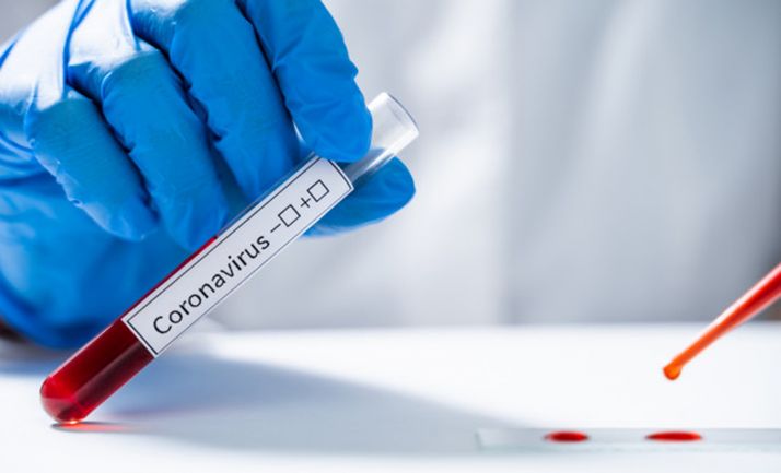 La Cátedra de Caja Rural y la UVa lanzan una convocatoria de ayudas a proyectos de investigación relacionados con el COVID-19