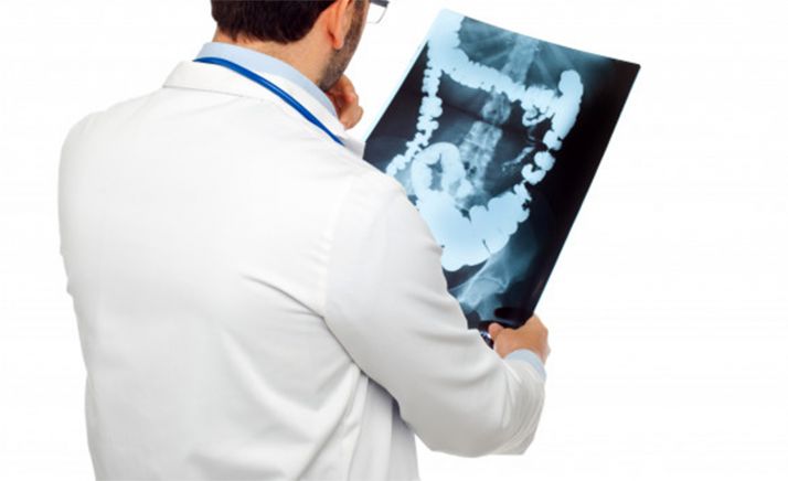 El cáncer colorectal, el más frecuente en Soria