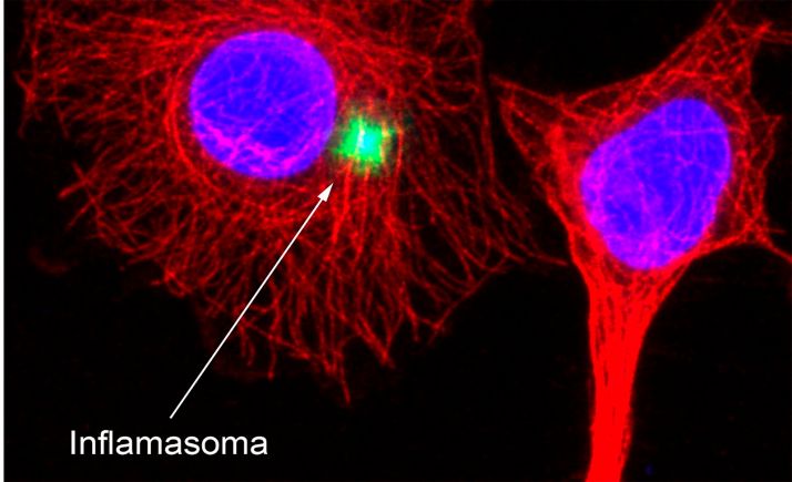 Desarrollan una plataforma que permite ver en tiempo real si un fármaco inhibe la respuesta celular inmunitaria causada por el coronavirus