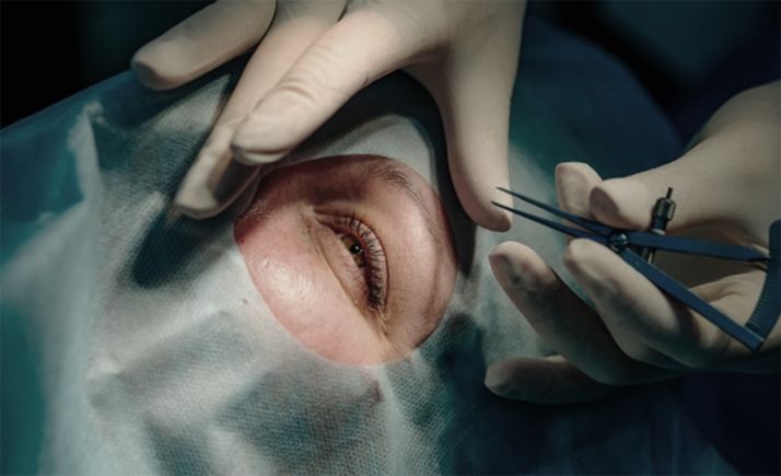 El TSJCyL condena a la Junta a indemnizar a un paciente por un error en una operación de cataratas