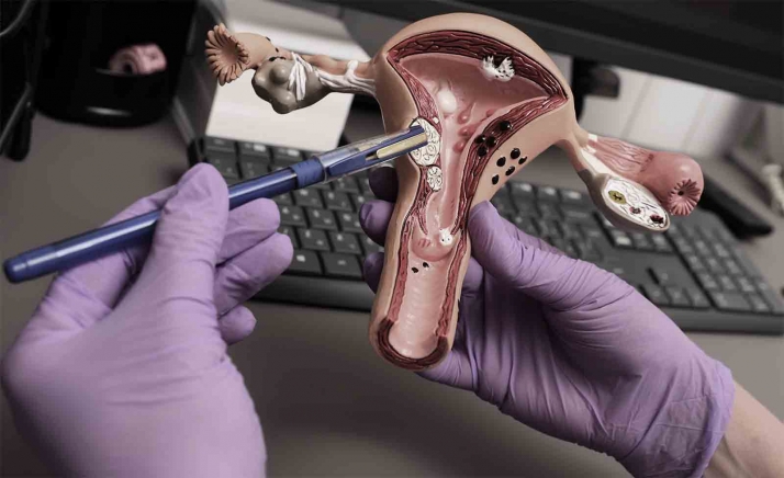 La Junta contata un servicio de diagnóstico citológico para el programa de prevención y detección precoz del cáncer de cuello de útero