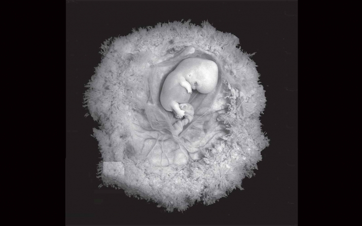 Las mujeres embarazadas con COVID-19 corren más riesgos de desarrollar preeclampsia