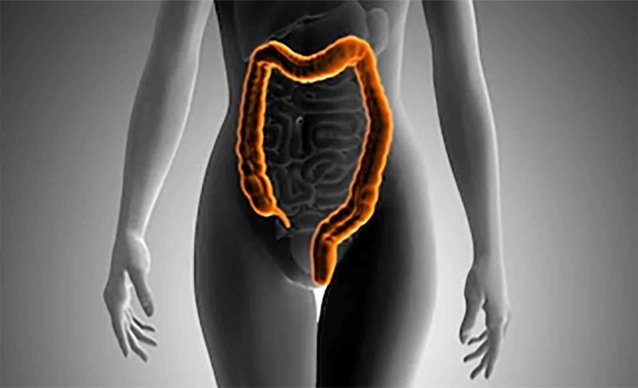 TRIBUNA: Este jueves, Día mundial del cáncer de colon