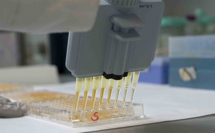 Los test serológicos para la COVID-19 del CSIC se producirán en Sudáfrica para llegar a los países africanos