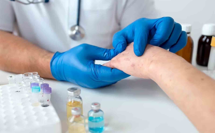 Castilla y León destina 5 M€ para la adquisición de vacunas frente al herpes zóster