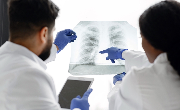 Un hallazgo en Salamanca abre la vía a terapias personalizadas para el cáncer de pulmón más resistente