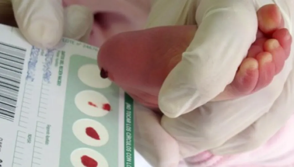 La prueba del talón favorece la detección precoz de enfermedades