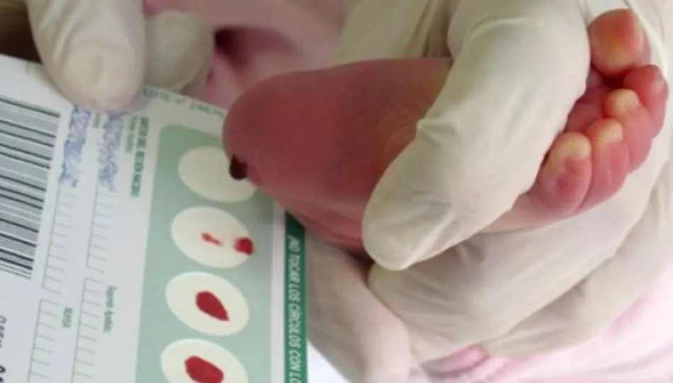 La prueba del talón favorece la detección precoz de enfermedades