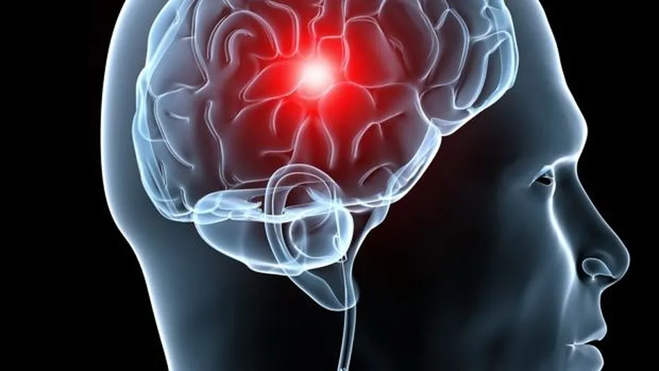 La mitad de los afectados no se recupera totalmente, quedando en ellos unas secuelas por daño cerebral