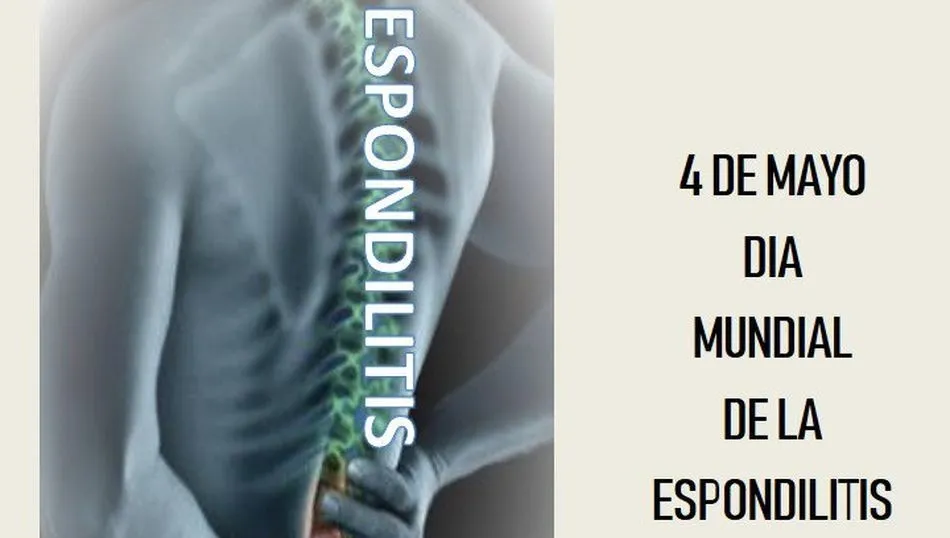 El ejercicio físico ayuda a mejorar la movilidad de los pacientes con EA