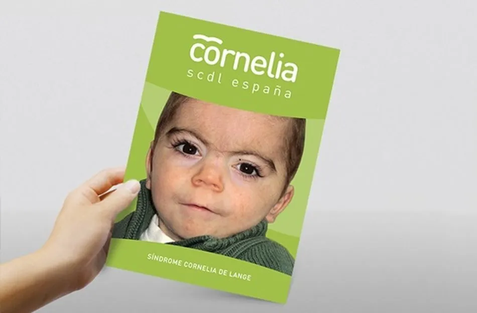 ¿Qué es el Síndrome de Cornelia de Lange?