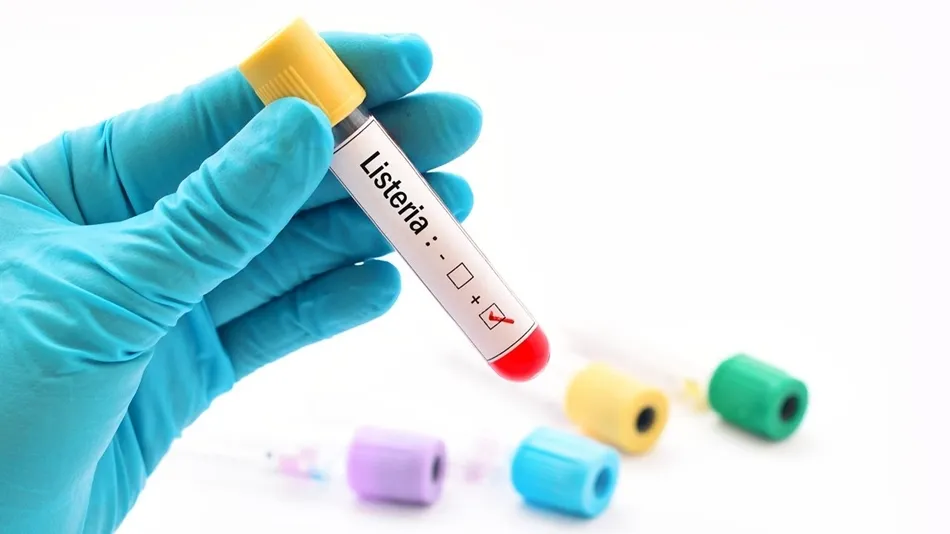 Lo que quizá no sabías de la listeriosis  