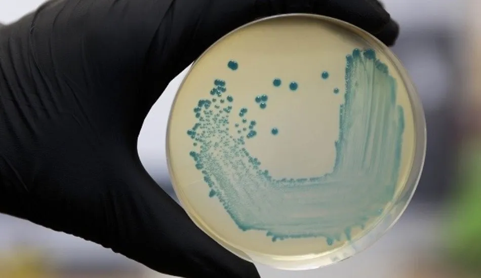 Una placa con la bacteria de la listeriosis. Foto de archivo de EP