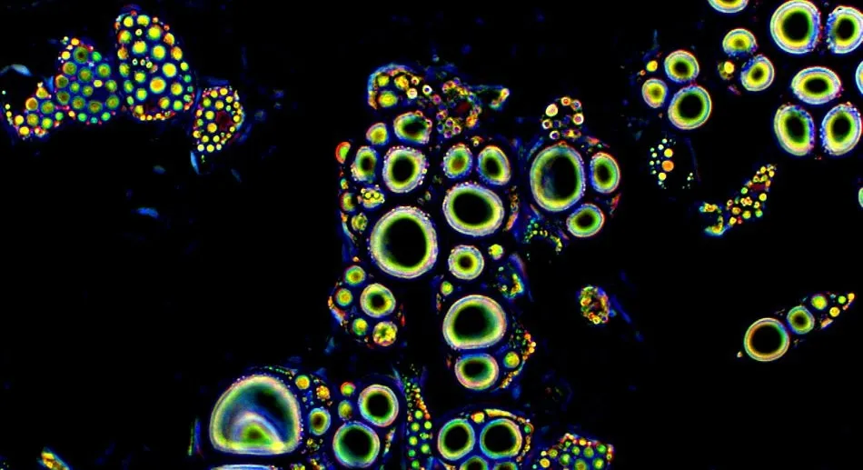 Descubren una nueva forma farmacéutica que elimina las células madre metastáticas  