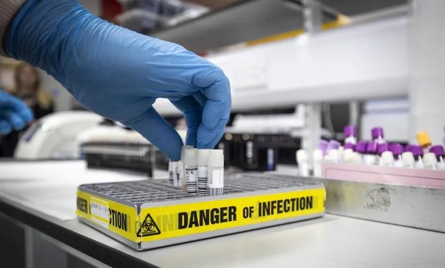 Castilla y León recibirá 50.000 pruebas de detección