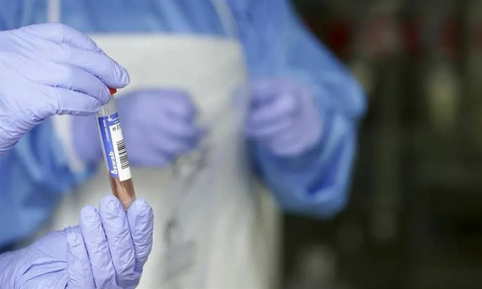 Más de un centenar de investigaciones en marcha en el mundo para encontrar la vacuna contra la COVID-19