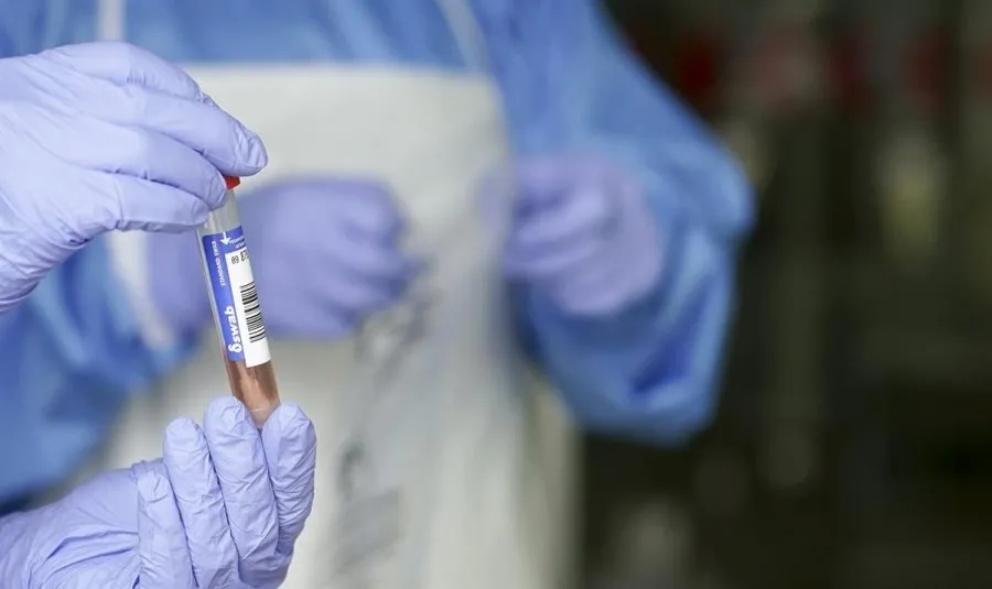 Imangen de archivo de las pruebas PCR, que facilitan la localización de positivos y la prevención de nuevos contagios. Foto EP