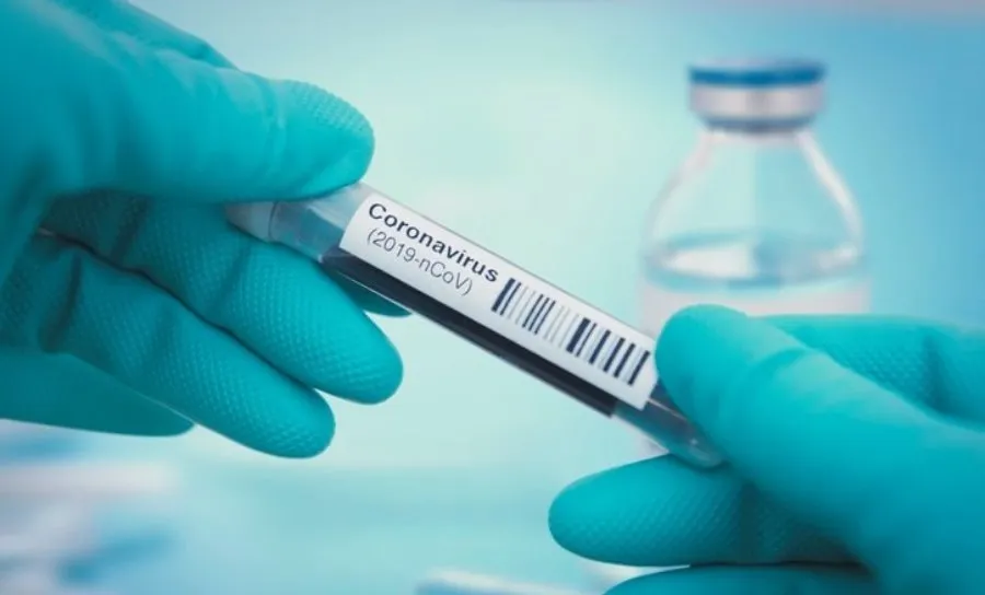 Los nuevos positivos se han declarado atendiendo a la definición de caso confirmado de infección por SARS-CoV-2 adoptada por la Autoridad sanitaria nacional