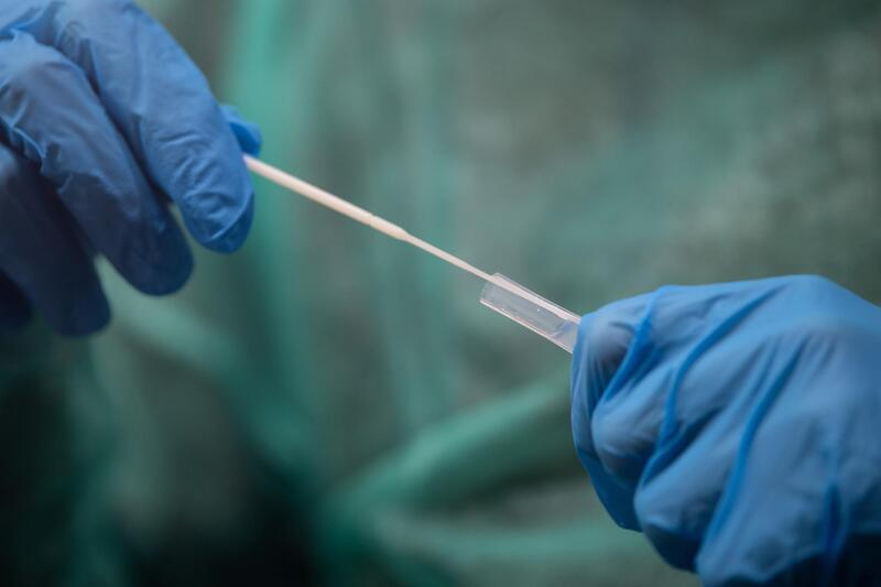 España suma 182.123 nuevos casos de COVID-19 y 259 muertes desde el viernes, con la incidencia bajando a 2.880