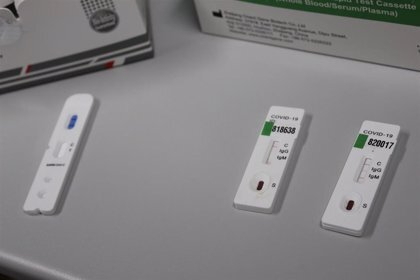 Detectados 68 positivos en los test masivos realizados en Castellanos de Moriscos, Aldeatejada y Tamames 