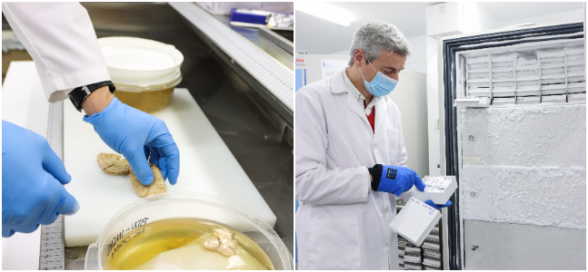 Así es el Banco de Tejidos Neurológicos de la USAL, referencia de Castilla y León en el estudio del Parkinson