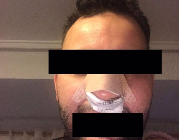 Moro de mierda, te mato: investigan una presunta agresión racista de vigilantes en una discoteca en Valencia