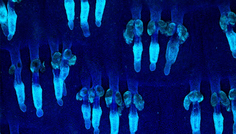 El Centro de Investigación del Cáncer identifica dos proteínas que modulan el comportamiento de las células madre de la piel