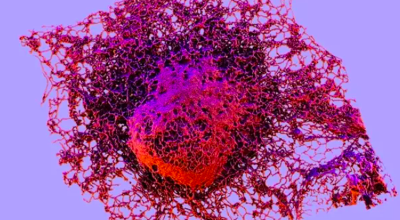 Descubren un mecanismo de progresión del cáncer presente en el 90% de células cancerosas