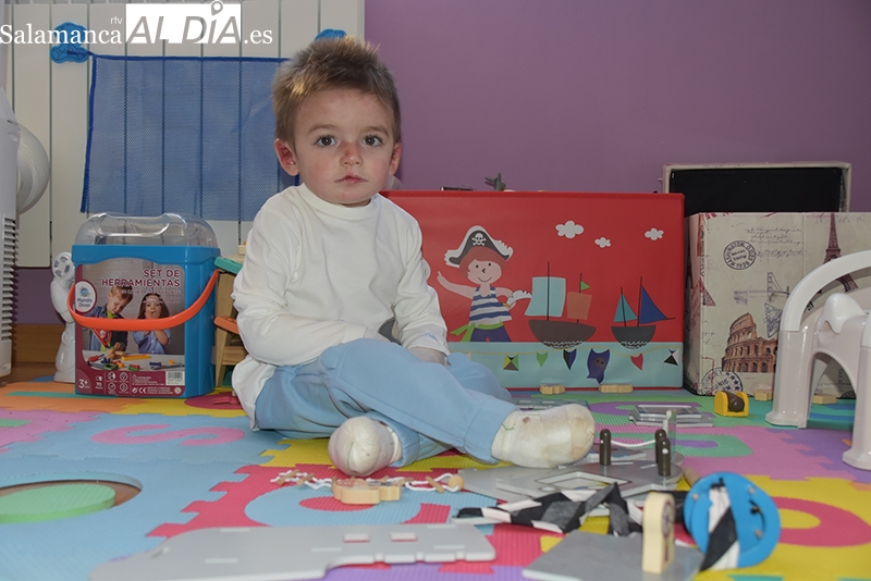 Javi, un superhéroe salmantino con Piel de Mariposa