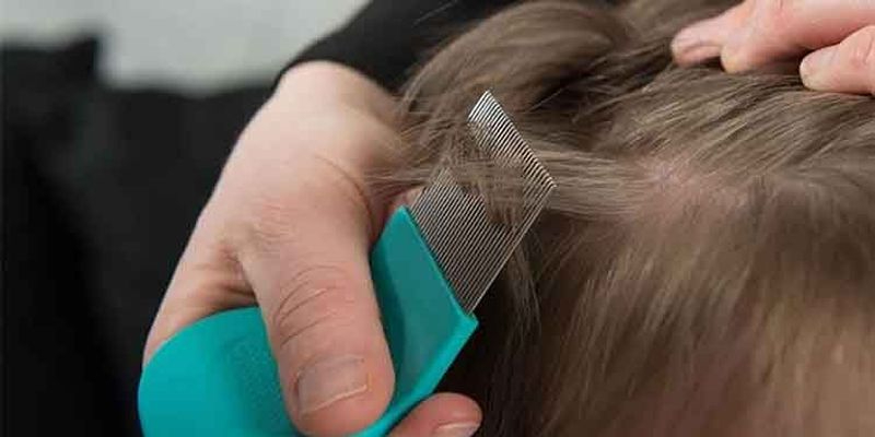 Estos son los productos más eficaces para combatir los piojos 