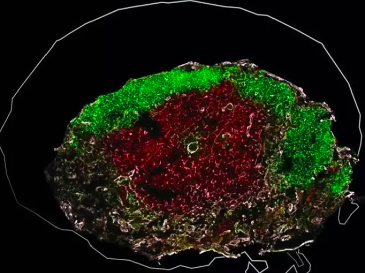 Se puede retrasar el envejecimiento, así lo demuestra un estudio