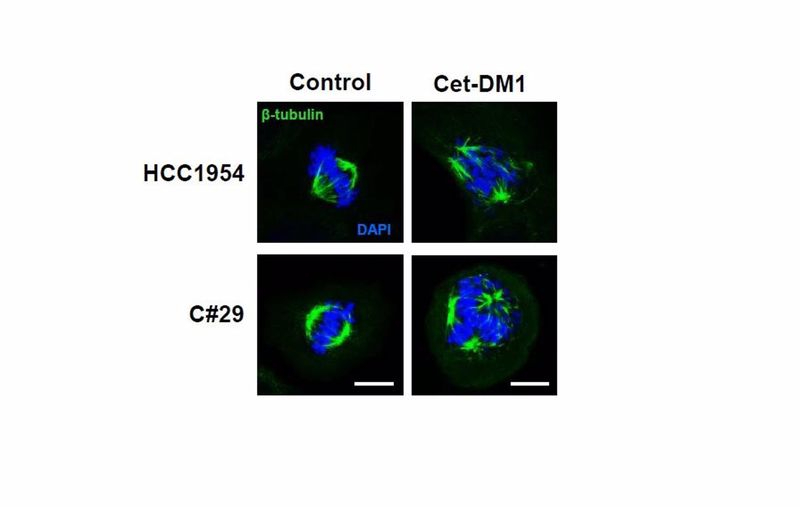 Investigadores salmantinos identifican una nueva diana para el tratamiento de cáncer de mama