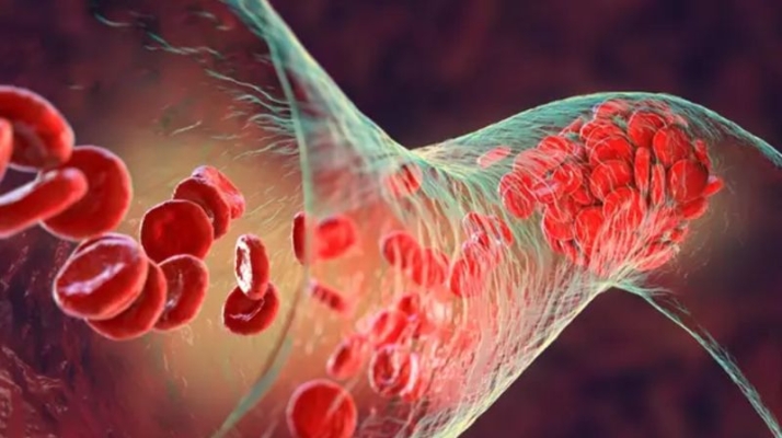 Una muestra de sangre 24 horas después del inicio de la quimioterapia predice la supervivencia