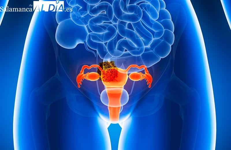 Importante avance en CyL para prevenir y detectar el cáncer de cuello de útero