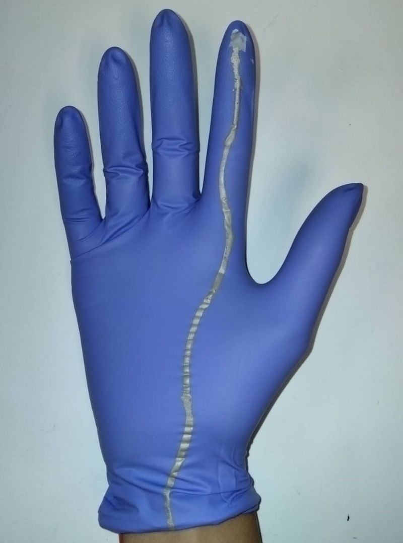 El guante inteligente diseñado por una ingeniera de CyL que ayuda en partos difíciles