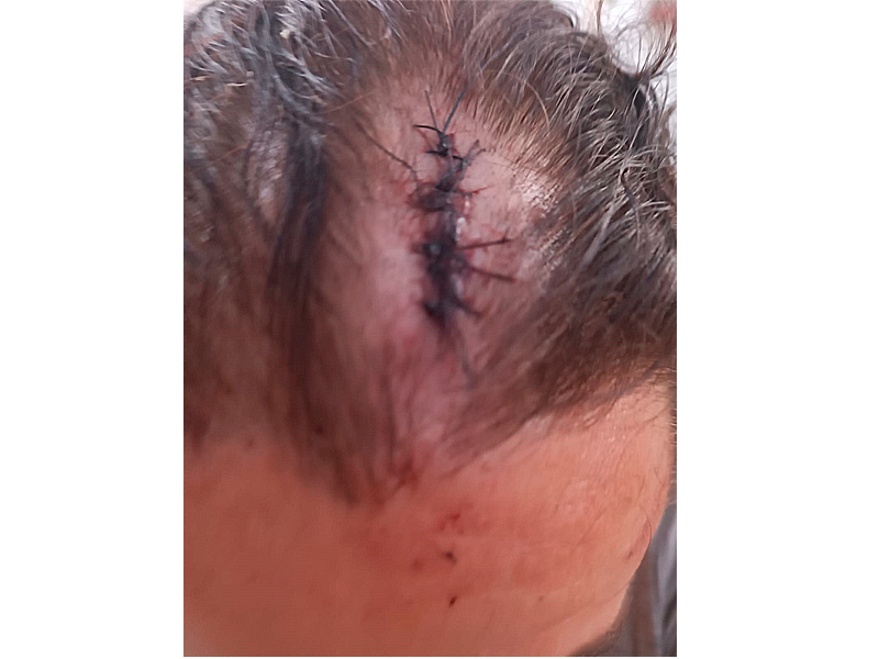 agresion secretaria comunidad regantes pantano agueda