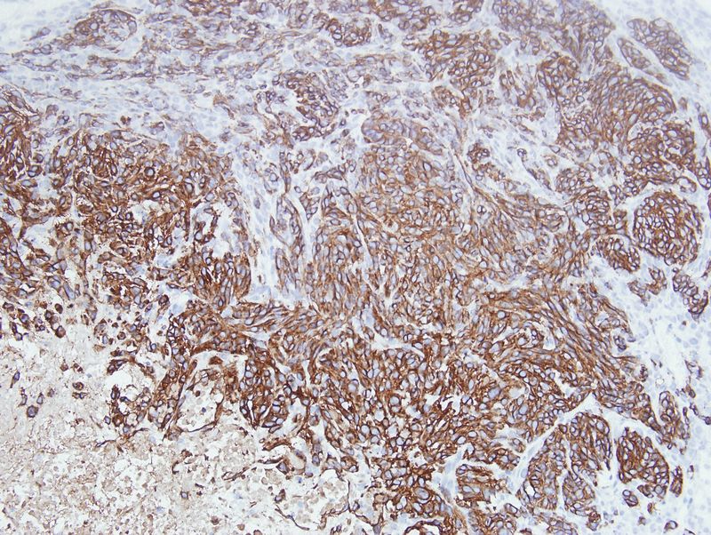 Investigadores de Salamanca colaboran en un nuevo fármaco contra el cáncer