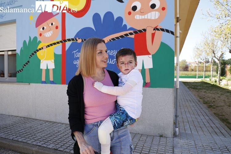 Una carrera solidaria para visibilizar la Piel de Mariposa en Santa Marta 