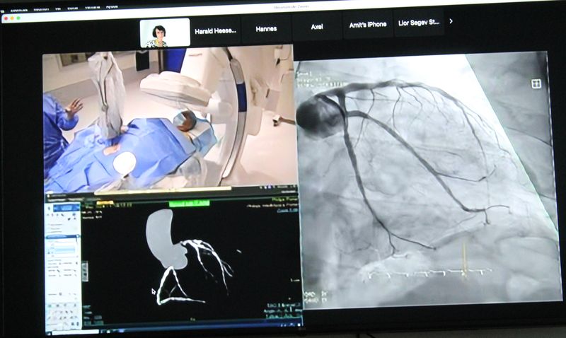 El Hospital de Salamanca prueba por primera vez en el mundo una tecnología pionera en el abordaje de la cardiopatía isquémica