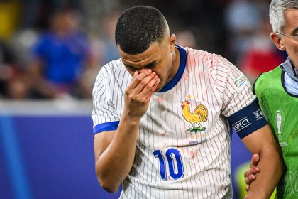 Mbappé se rompe la nariz en el estreno victorioso de Francia en la Eurocopa (0-1)