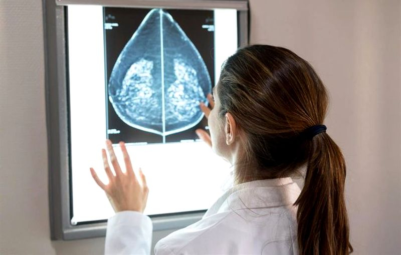 Sanidad financiará fármacos para pacientes con cáncer de mama metastásico