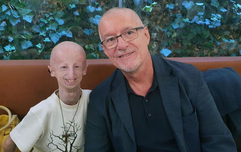 Fallece Sammy Basso, el paciente con progeria más longevo del mundo