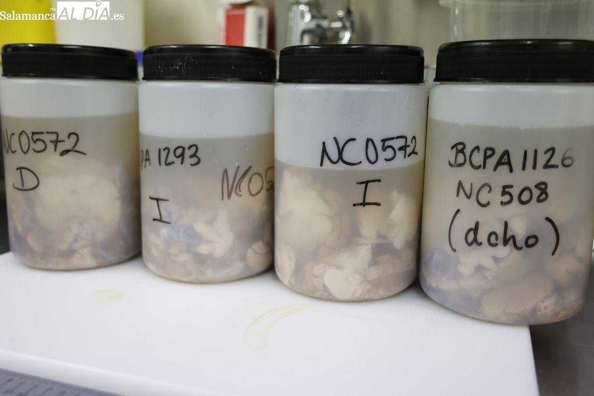 ¿Quién puede donar su cerebro en Salamanca y para qué sirve?