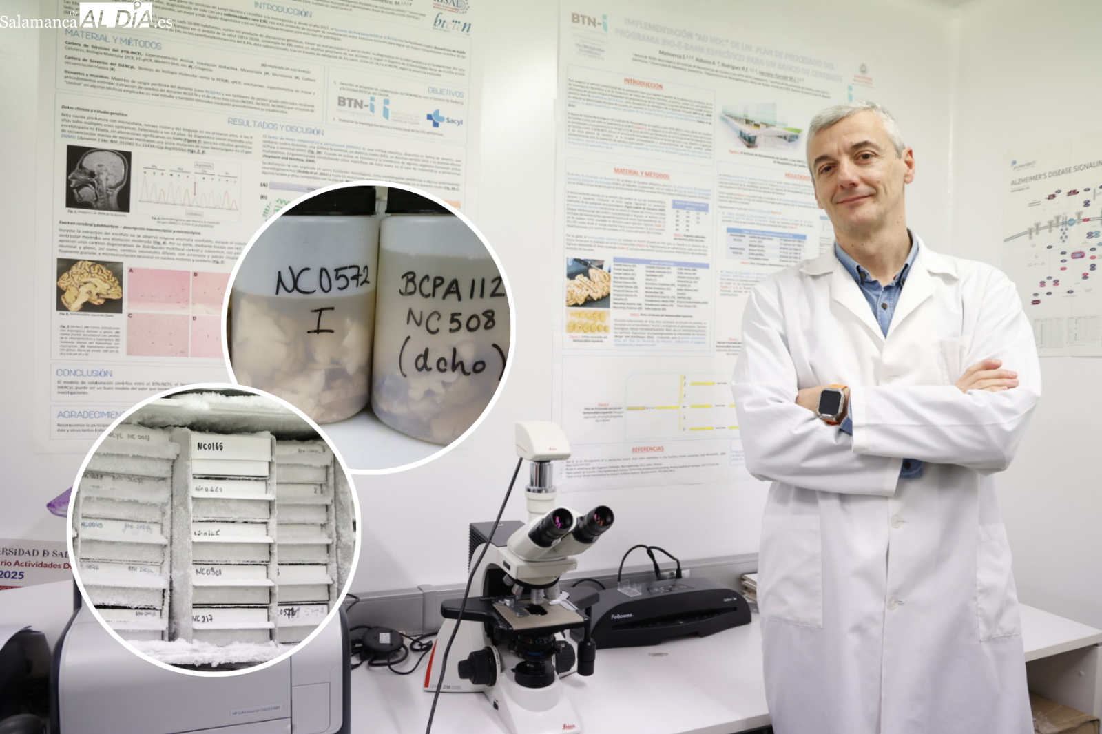 Así es el ‘Banco de cerebros’ de Salamanca: clave para el presente y futuro de la neurociencia 