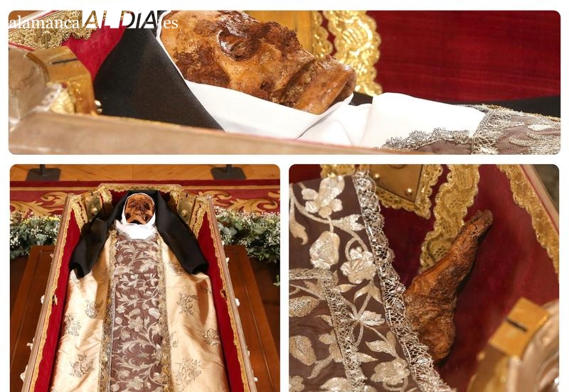 El cuerpo de Santa Teresa: un mapa de dolor y resistencia a los 67 años