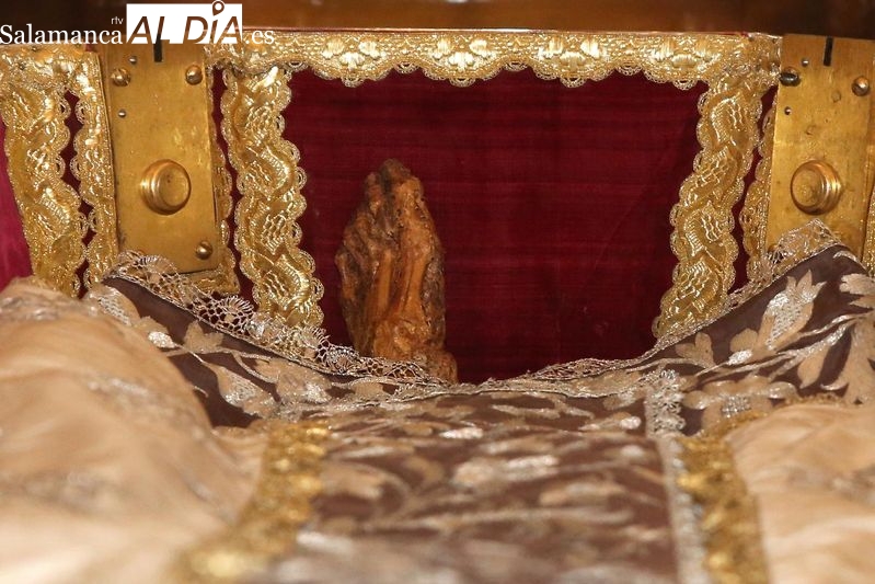 Artrosis y espolones: las dolencias que limitaron los pasos de Santa Teresa