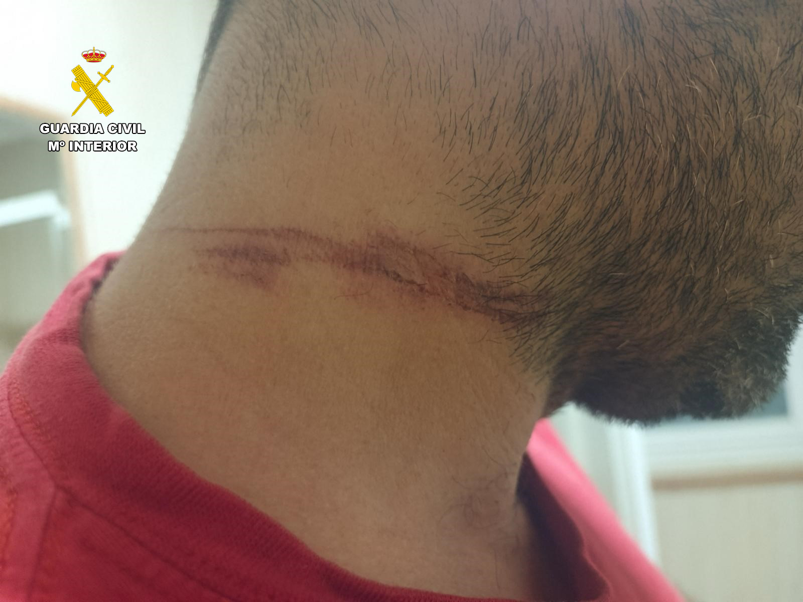 Se enfrenta a dos años de cárcel por tender un pastor eléctrico y herir a un motorista